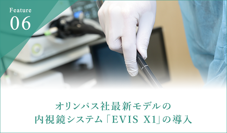 オリンパス社最新モデルの 内視鏡システム 「EVIS X1」の導入