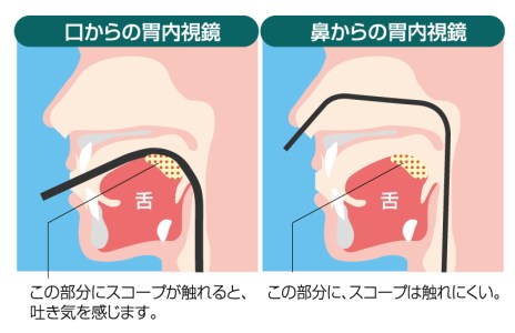 経口・経鼻内視鏡