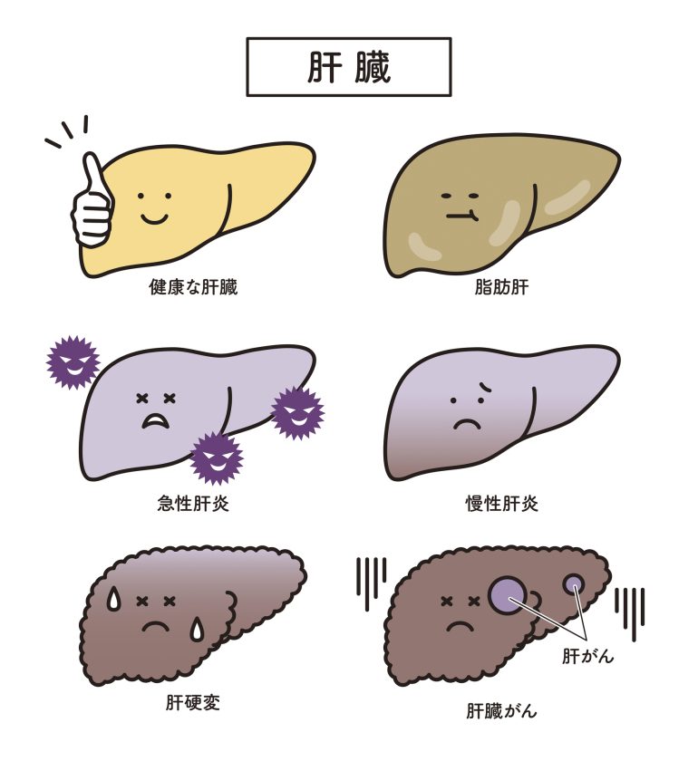 肝臓疾患について