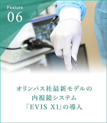 オリンパス社最新モデルの 内視鏡システム 「EVIS X1」の導入